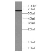 WB analysis of mouse brain tissue, using WDR81 antibody (1/300 dilution).