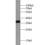 WB analysis of mouse kidney tissue, using WNT7A antibody (1/1000 dilution).