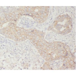 WD Repeat And SOCS Box-Containing Protein 1 (WSB1) Antibody