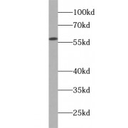 WB analysis of SGC-7901 cells, using WSB1 antibody (1/1000 dilution).