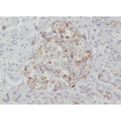 WD Repeat And SOCS Box-Containing Protein 2 (WSB2) Antibody