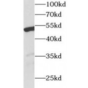 WB analysis of human kidney tissue, using WT1 antibody (1/300 dilution).