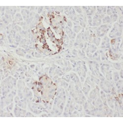 NEDD4-Like E3 Ubiquitin-Protein Ligase WWP2 (WWP2) Antibody