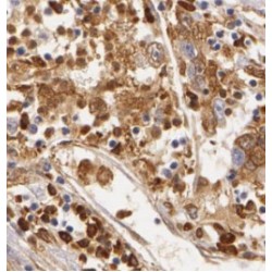 X-Box-Binding Protein 1 (XBP1) Antibody