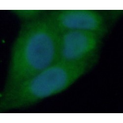 E3 Ubiquitin-Protein Ligase XIAP (XIAP) Antibody