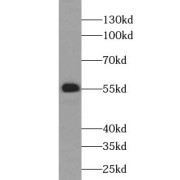 WB analysis of HepG2 cells, using XIAP antibody (1/1000 dilution).