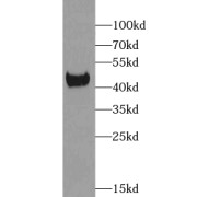 WB analysis of Jurkat cells, using XKR6 antibody (1/1000 dilution).