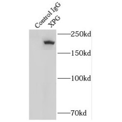 DNA Repair Protein Complementing XP-G Cells (ERCC5) Antibody