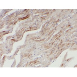 5'-3' Exoribonuclease 1 (XRN1) Antibody