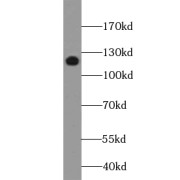 WB analysis of HEK-293 cells, using XYLT1 antibody (1/300 dilution).