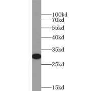 WB analysis of human liver tissue, using YIPF5 antibody (1/500 dilution).