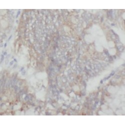 Mitogen-Activated Protein Kinase Kinase Kinase MLT (ZAK) Antibody