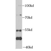 WB analysis of HepG2 cells, using ZAK antibody (1/1000 dilution).