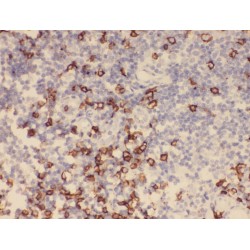 Tyrosine-Protein Kinase ZAP-70 (ZAP70) Antibody