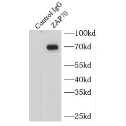Tyrosine-Protein Kinase ZAP-70 (ZAP70) Antibody
