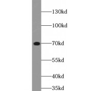 WB analysis of Jurkat cells, using ZAP70 antibody (1/3000 dilution).