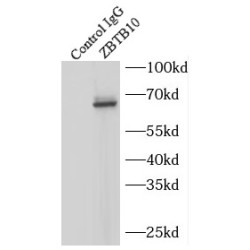 Zinc Finger And BTB Domain-Containing Protein 10 (ZBTB10) Antibody
