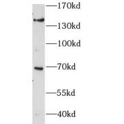 WB analysis of mouse liver tissue, using ZBTB11 antibody (1/600 dilution).