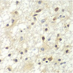 Zinc Finger And BTB Domain-Containing Protein 48 (ZBTB48) Antibody