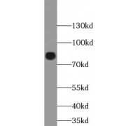 WB analysis of K-562 cells, using ZBTB48 antibody (1/1000 dilution).