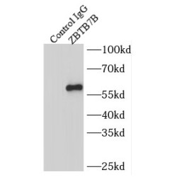 Zinc Finger And BTB Domain-Containing Protein 7B (ZBTB7B) Antibody