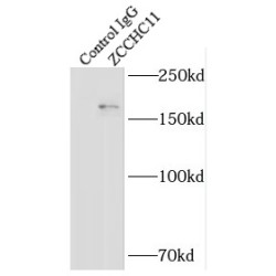 Zinc Finger CCHC Domain-Containing Protein 11 (ZCCHC11) Antibody