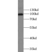 WB analysis of HepG2 cells, using ZCCHC8 antibody (1/1000 dilution).