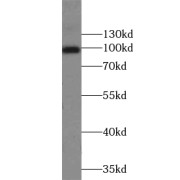 WB analysis of HepG2 cells, using ZCCHC8 antibody (1/1000 dilution).