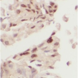 Zinc Finger E-Box-Binding Homeobox 1 (ZEB1) Antibody