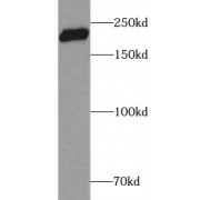 WB analysis of MCF7 cells, using ZEB1 antibody (1/500 dilution).