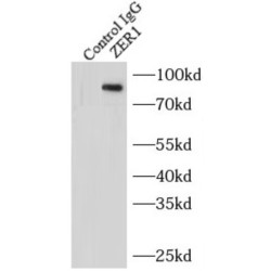 Protein Zer-1 Homolog (ZER1) Antibody