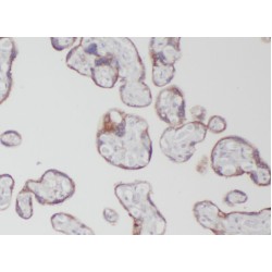 mRNA Decay Activator Protein ZFP36L1 (ZFP36L1) Antibody