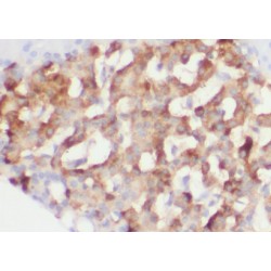 Zymogen Granule Membrane Protein 16 (ZG16) Antibody