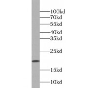 WB analysis of human colon tissue, using ZG16 antibody (1/500 dilution).