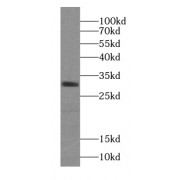 WB analysis of mouse ovary tissue, using ZGLP1 antibody (1/300 dilution).