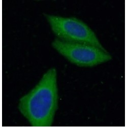 Zinc Transporter ZIP8 (ZIP8) Antibody