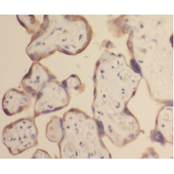 Zinc Transporter ZIP8 (ZIP8) Antibody
