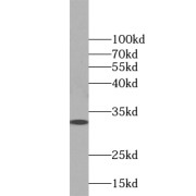 WB analysis of mouse testis tissue, using ZMAT3 antibody (1/800 dilution).