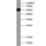WB analysis of PC-3 cells, using ZMPSTE24 antibody (1/400 dilution).