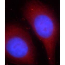 Zinc Finger Protein 140 (ZNF140) Antibody