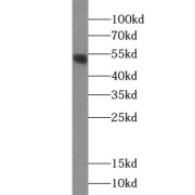 WB analysis of SKOV-3 cells, using ZNF140 antibody (1/1000 dilution).