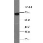 WB analysis of HepG2 cells, using ZNF143 antibody (1/800 dilution).