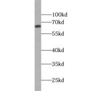 WB analysis of HepG2 cells, using ZNF192 antibody (1/500 dilution).