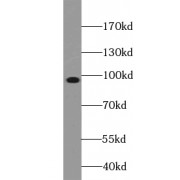 WB analysis of mouse heart tissue, using ZNF366 antibody (1/300 dilution).