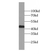 WB analysis of mouse kidney tissue, using ZNF385D antibody (1/500 dilution).