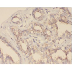 Zinc Finger Protein 395 (ZNF395) Antibody
