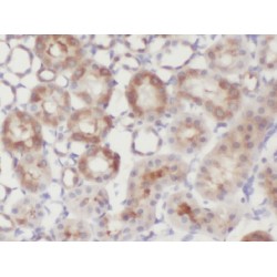 Zinc Finger Protein 497 (ZNF497) Antibody