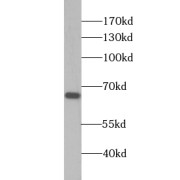 WB analysis of PC-3 cells, using ZNF512 antibody (1/300 dilution).