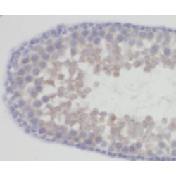 Zinc Finger Protein 654 (ZNF654) Antibody
