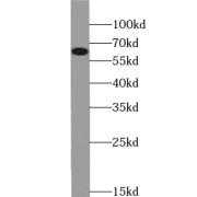 WB analysis of HepG2 cells, using ZNF671 antibody (1/500 dilution).